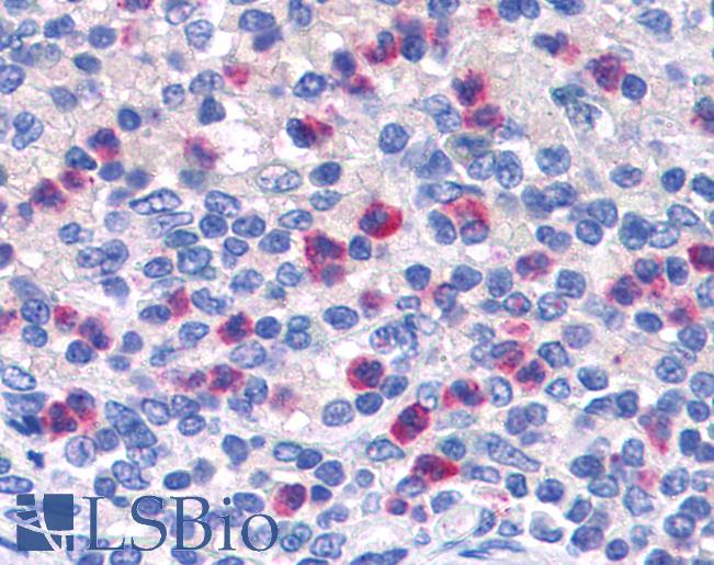 Anti-PGLYRP1 / PGRP antibody IHC of human spleen. Immunohistochemistry of formalin-fixed, paraffin-embedded tissue after heat-induced antigen retrieval. Antibody LS-B4940 concentration 3.75 ug/ml.