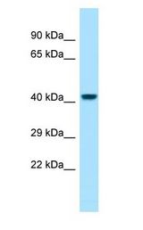 PGLYRP3 antibody Western Blot of Fetal Heart.