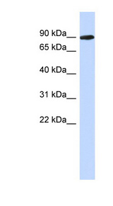 PGM2L1 antibody LS-C111674 Western blot of Placenta lysate.