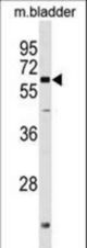 PGM2L1 Antibody western blot of mouse bladder tissue lysates (35 ug/lane). The PGM2L1 antibody detected the PGM2L1 protein (arrow).
