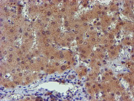 IHC of paraffin-embedded Human liver tissue using anti-PGM3 mouse monoclonal antibody.