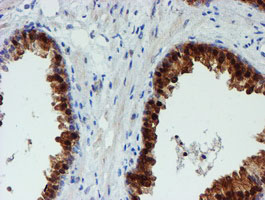 IHC of paraffin-embedded Human prostate tissue using anti-PGM3 mouse monoclonal antibody.