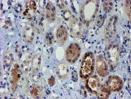IHC of paraffin-embedded Human Kidney tissue using anti-PGM3 mouse monoclonal antibody.
