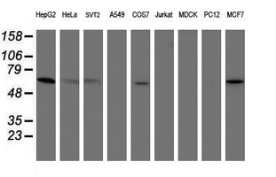 Western blot of extracts (35 ug) from 9 different cell lines by using g anti-PGM3 monoclonal antibody (HepG2: human; HeLa: human; SVT2: mouse; A549: human; COS7: monkey; Jurkat: human; MDCK: canine; PC12: rat; MCF7: human).