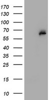HEK293T cells were transfected with the pCMV6-ENTRY control (Left lane) or pCMV6-ENTRY PGM3 (Right lane) cDNA for 48 hrs and lysed. Equivalent amounts of cell lysates (5 ug per lane) were separated by SDS-PAGE and immunoblotted with anti-PGM3.
