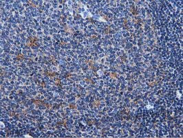 IHC of paraffin-embedded Human lymph node tissue using anti-MICAL1 mouse monoclonal antibody.