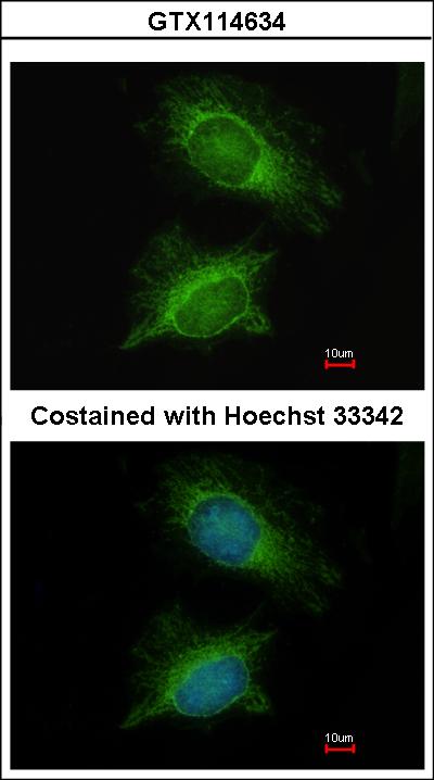 Immunofluorescence of methanol-fixed HeLa using PGM3 antibody at 1:200 dilution.