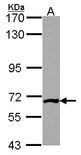 Sample (30 ug of whole cell lysate). A: JurKat. 7.5% SDS PAGE. PGM3 antibody diluted at 1:1000.