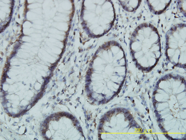 Immunoperoxidase of monoclonal antibody to PGM3 on formalin-fixed paraffin-embedded human colon tissue. [antibody concentration 2 ug/ml].