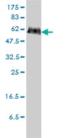 PGM3 monoclonal antibody (M01), clone 1E2-1B12 Western blot of PGM3 expression in HeLa.