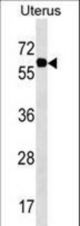 PGM3 Antibody western blot of Uterus tissue lysates (35 ug/lane). The PGM3 antibody detected the PGM3 protein (arrow).