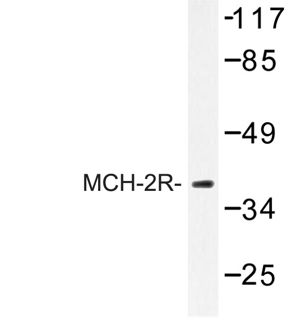 Western blot of MCH-2R (M332) pAb in extracts from HUVEC cells.