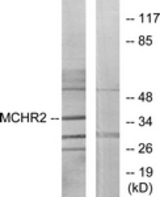 Western blot of extracts from HUVEC cells, using MCHR2 Antibody. The lane on the right is treated with the synthesized peptide.
