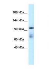 MICAL1 antibody LS-C145577 Western blot of Placenta lysate. Antibody concentration 1 ug/ml.