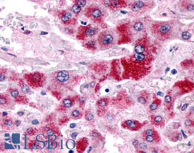 Anti-GPR153 antibody LS-A3141 IHC of human liver, hepatocytes. Immunohistochemistry of formalin-fixed, paraffin-embedded tissue after heat-induced antigen retrieval.
