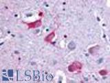 Anti-MCHR2 antibody LS-A1849 IHC of human brain, neurons. Immunohistochemistry of formalin-fixed, paraffin-embedded tissue after heat-induced antigen retrieval.