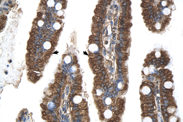 PGRMC1 antibody LS-C80930 IHC of formalin-fixed, paraffin-embedded human Intestine. Positive label: Epithelial cells of intestinal villas indicated with arrows. Antibody concentration 4-8 ug/ml. Magnification 400X.