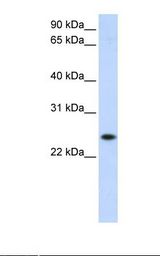 HepG2 cell lysate. Antibody concentration: 1.0 ug/ml. Gel concentration: 12%.