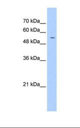 Jurkat cell lysate. Antibody concentration: 1.25 ug/ml. Gel concentration: 12%.
