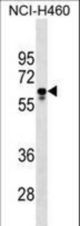 PGS1 Antibody western blot of NCI-H460 cell line lysates (35 ug/lane). The PGS1 antibody detected the PGS1 protein (arrow).