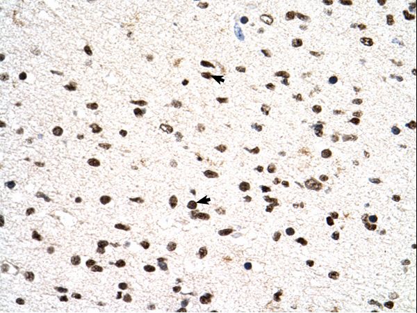 PGS1 antibody LS-C81316 was used in IHC to stain formalin-fixed, paraffin-embedded human brain.