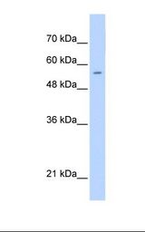 Jurkat cell lysate. Antibody concentration: 0.25 ug/ml. Gel concentration: 12%.