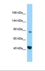 Western blot of Human HepG2. MICAL2 antibody dilution 1.0 ug/ml.