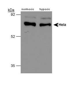 Western blot of human PHD4. Samples: whole cell lysate from HeLa cells, normoxic and hypoxic, respectively.