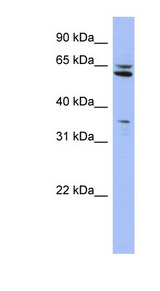 P4HTM antibody LS-C112120 Western blot of HepG2 cell lysate.