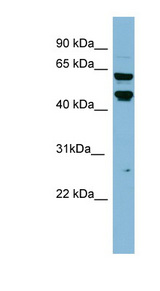 P4HTM antibody LS-C107605 Western blot of HT1080 cell lysate.