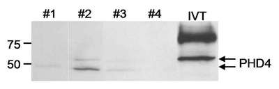 Detection of Human PHD4 by Western Blot. Samples: Whole cell lysate (25 ug/lane) from human glioblastoma tumor cell lines or in vitro translated PHD4. Antibody: Affinity purified rabbit anti-PHD4 used at 2 ug/ml. Detection: Chemiluminescence.