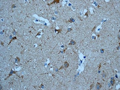 IHC of paraffin-embedded human brain tissue using anti-PHD4 antibody.