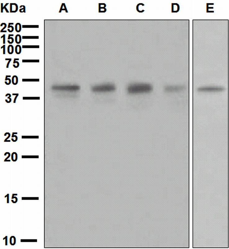 Western blot analysis on (A) 293T, (B) U87-MG, (C) HeLa, (D) HepG2, and (E) SH-SY5Y cell lysates using anti-PHD4 antibody.