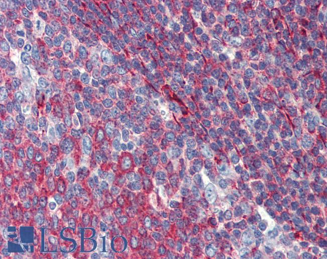 Anti-PHACTR1 antibody IHC of human tonsil. Immunohistochemistry of formalin-fixed, paraffin-embedded tissue after heat-induced antigen retrieval. Antibody LS-B4000 concentration 5 ug/ml.