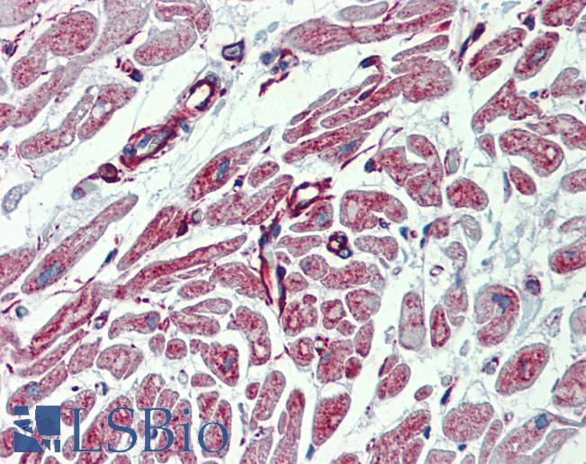 Anti-PHACTR1 antibody IHC of human heart. Immunohistochemistry of formalin-fixed, paraffin-embedded tissue after heat-induced antigen retrieval. Antibody LS-B4000 concentration 5 ug/ml.