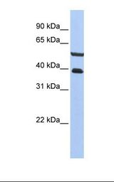 HepG2 cell lysate. Antibody concentration: 1.0 ug/ml. Gel concentration: 12%.