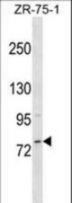 MICALCL Antibody western blot of ZR-75-1 cell line lysates (35 ug/lane). The MICALCL antibody detected the MICALCL protein (arrow).