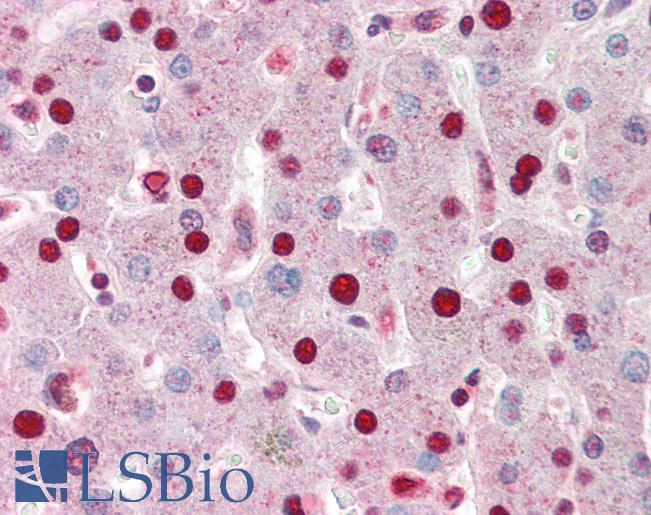 Anti-ANP32A antibody IHC of human liver. Immunohistochemistry of formalin-fixed, paraffin-embedded tissue after heat-induced antigen retrieval. Antibody LS-B3194 concentration 5 ug/ml.