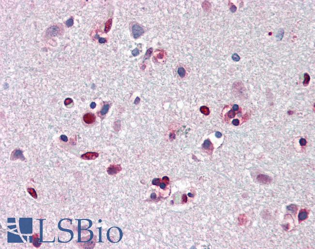 Anti-ANP32A antibody IHC of human brain, cortex. Immunohistochemistry of formalin-fixed, paraffin-embedded tissue after heat-induced antigen retrieval. Antibody LS-B3194 concentration 5 ug/ml.