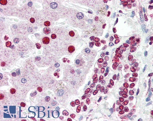 Anti-ANP32A antibody IHC of human liver. Immunohistochemistry of formalin-fixed, paraffin-embedded tissue after heat-induced antigen retrieval. Antibody LS-B3195 concentration 5 ug/ml.