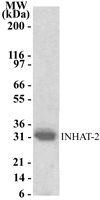 Western blot detection of INHAT-2 using antibody at a 1:1000 dilution against 10 ug of HeLa cell lysate.