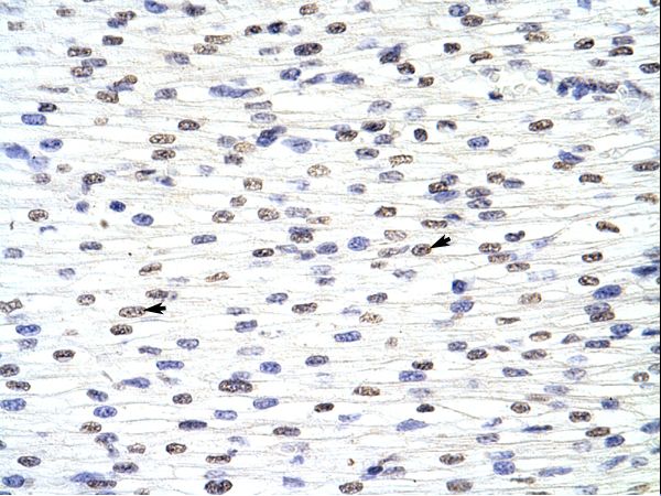 ANP32A antibody LS-C30659 was used in IHC to stain formalin-fixed, paraffin-embedded human heart.
