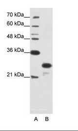 A: Marker, B: Jurkat Cell Lysate