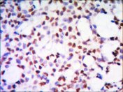 IHC of paraffin-embedded human kidney tissue using PP32 mouse mAb with DAB staining.