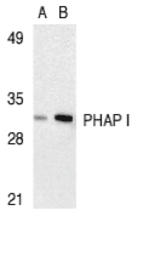 Western blot of PHAP I expression in human Raji cell lysate with PHAP I antibody at 2 ug/ml (lane A) and 4 ug/ml (lane B), respectively.