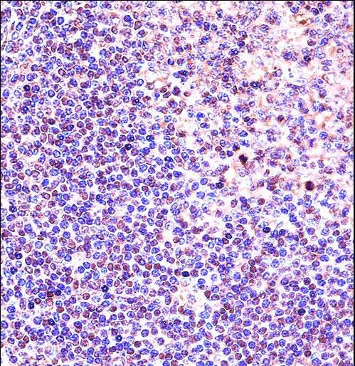 ANP32A Antibody immunohistochemistry of formalin-fixed and paraffin-embedded human tonsil tissue followed by peroxidase-conjugated secondary antibody and DAB staining.