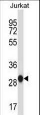 ANP32A Antibody western blot of Jurkat cell line lysates (35 ug/lane). The ANP32A antibody detected the ANP32A protein (arrow).