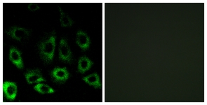 Immunofluorescence of A549 cells, using MBTPS2 Antibody. The picture on the right is treated with the synthesized peptide.