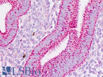 Human Uterus: Formalin-Fixed, Paraffin-Embedded (FFPE)