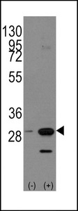 Western blot of PHB1 (arrow) using rabbit polyclonal PHB1 Antibody (Human C-term). 293 cell lysates (2 ug/lane) either nontransfected (Lane 1) or transiently transfected with the PHB1 gene (Lane 2) (Origene Technologies).